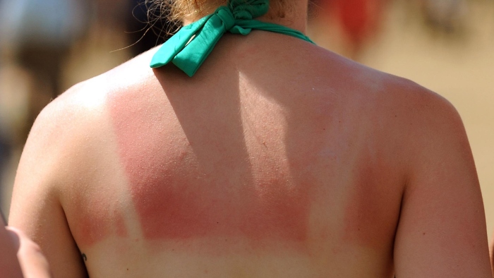 [DHC] Mách nàng 8 cách chống nắng tự nhiên hiệu quả cho làn da
