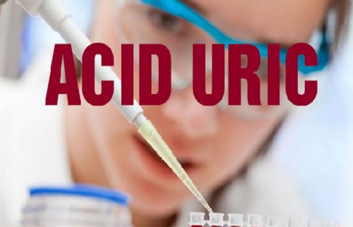 Chỉ số uric acid là gì? Cách cân bằng chỉ số acid uric